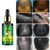 NATURAL 7 DAY HAIR GROWTH SERUM