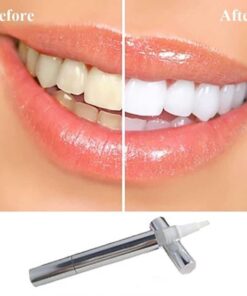 Teeth Whitening Pen