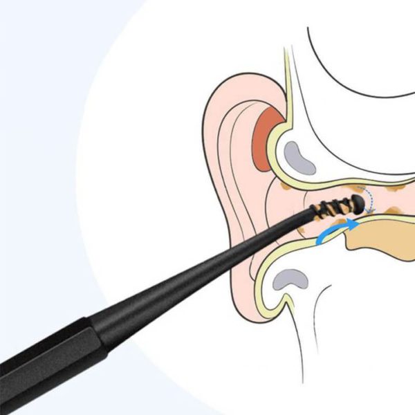 Mintiml NeWorld Earpick