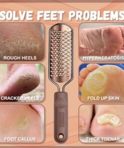 Feet Callus Safe Eliminator