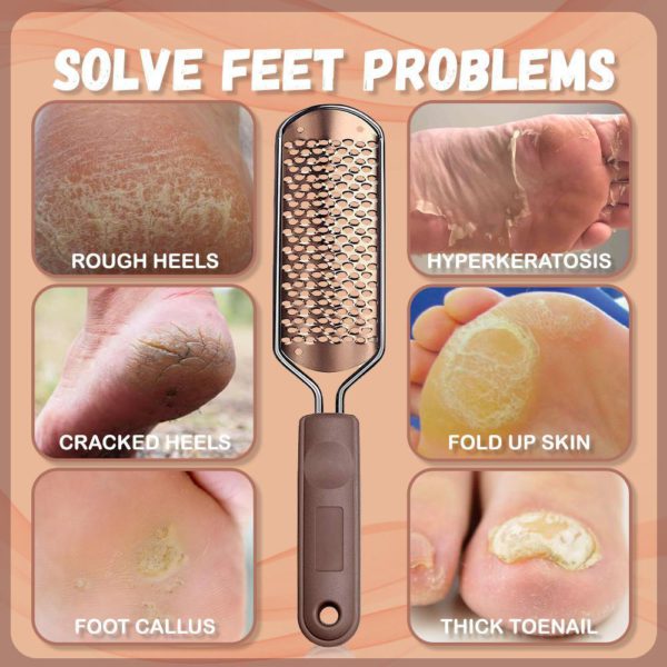 Feet Callus Safe Eliminator