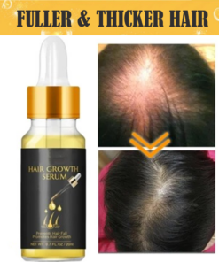 Biotin Thickening Herbal Serum🔥BUY 1 GET 1 FREE