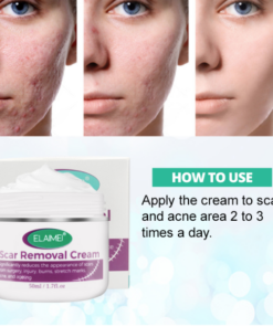 🔥BUY 2 GET 1 FREE🔥Scarless Skin Rebound Cream