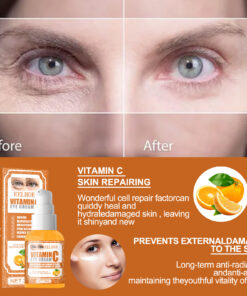 🔥Buy 2 Get 1 Free-EELHOE VITAMIN C EYE CREAM