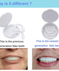 🔥50% OFF🔥 Magic Smile Teeth Brace 💝BUY 1 GET 1 FREE!