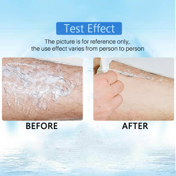 （🔥Hot Summer Sale - 50% OFF）2021 Magical Hair Inhibitor & Hair Removal💝BUY 1 GET 1 FREE!!