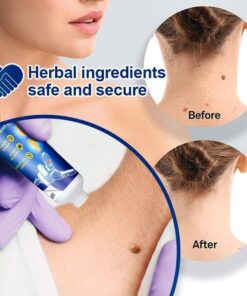 🔥Limited time discount 🔥 last day）Instant Blemish Removal Gel