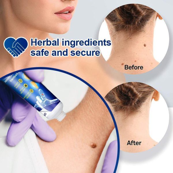 🔥Limited time discount 🔥 last day）Instant Blemish Removal Gel