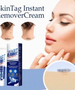 （🔥Hot Summer Sale - 50% OFF）SkinTag Instant Remover Cream💝BUY 1 GET 1 FREE!!