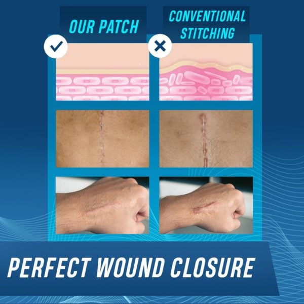 Recovery Closure Zipped Up Bandage Patch