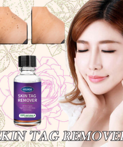 [SUMMER HOT SALE] Instant freckle removing essence