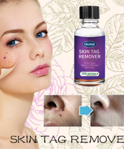 [SUMMER HOT SALE] Instant freckle removing essence