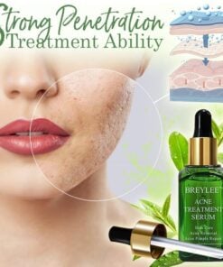 AcneAway Herbal Serum