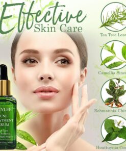 AcneAway Herbal Serum