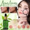 AcneAway Herbal Serum