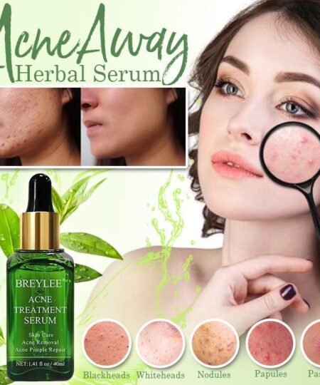 AcneAway Herbal Serum