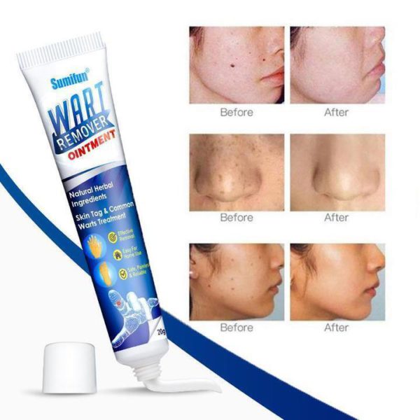 🔥Limited time discount 🔥 last day）Instant Blemish Removal Gel