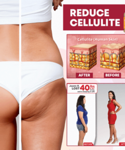 BurnUp! Cellulite Heating Spray