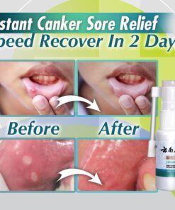 Mouth And Throat Sore Oral Spray