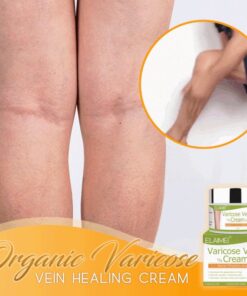 Organic Varicose Vein Healing Cream