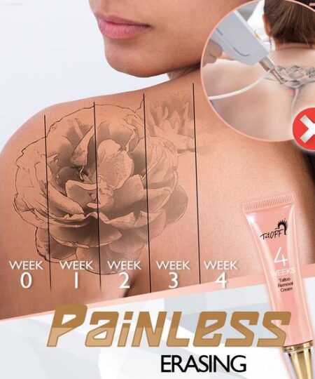 PainFree Tattoo Removal Cream