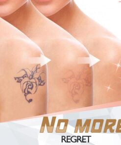 PainFree Tattoo Removal Cream