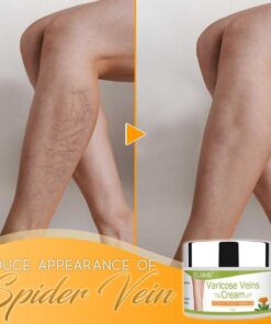 Organic Varicose Vein Healing Cream