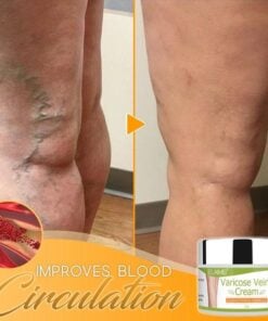 Organic Varicose Vein Healing Cream