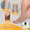 Organic Varicose Vein Healing Cream