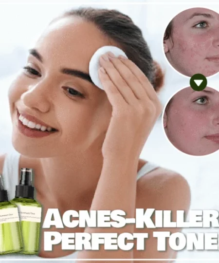 Acnes-Killer Perfect Toner