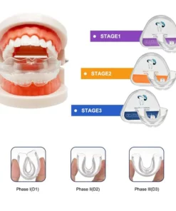 SmilePerfect Kit