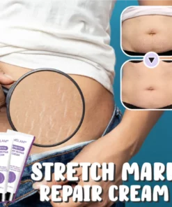 Stretch Mark Repair Cream