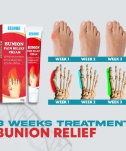 Bunion Relief Ointment Cream