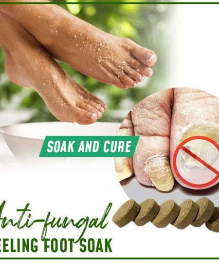 Anti-Fungal Peeling Foot Soak