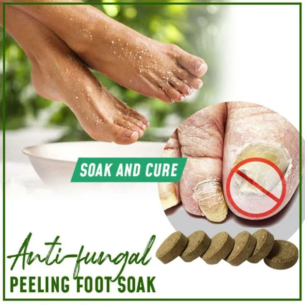 Anti-Fungal Peeling Foot Soak