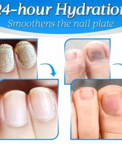 Nailthy™ Fungus Nail Repair Gel