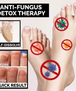 Anti-Fungal Peeling Foot Soak