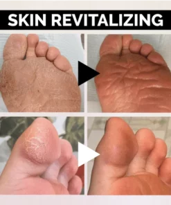 Anti-Fungal Peeling Foot Soak