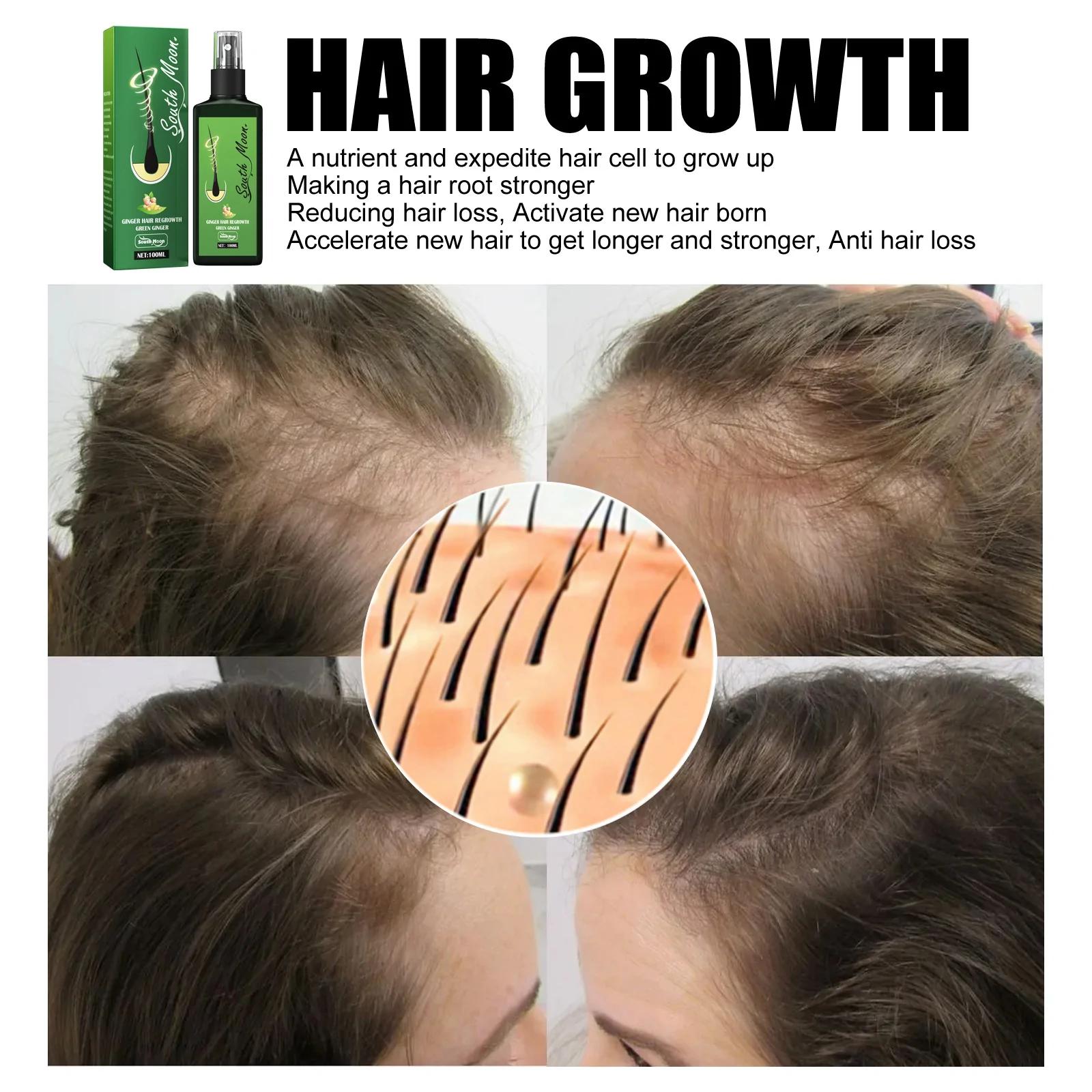 GrowthPlus Jaysuing Hair Spray - ultimate solution” for hair loss - Wowelo  - Your Smart Online Shop