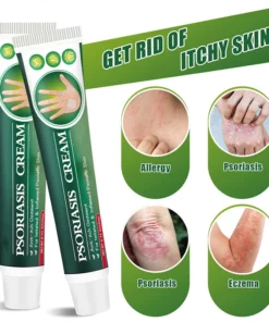 SHIRLN™ Psoriasis Cream