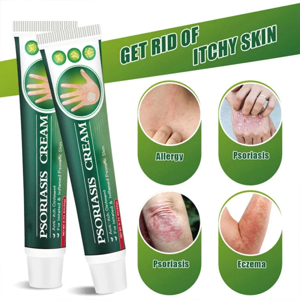 SHIRLN™ Psoriasis Cream