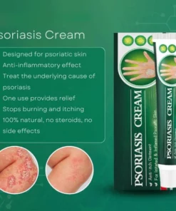 SHIRLN™ Psoriasis Cream