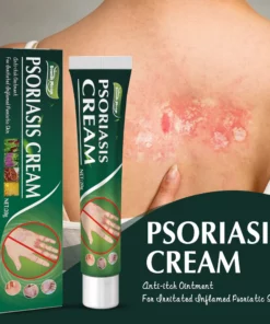 South Moon™ Psoriasis Cream