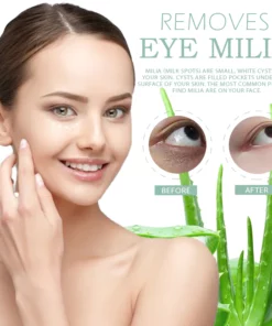 SkinFIX EyeMilia Removal HerbalCream