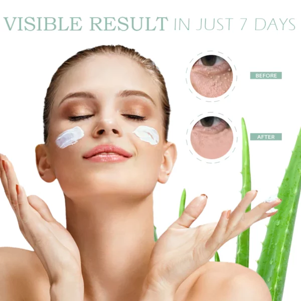 SkinFIX EyeMilia Removal HerbalCream