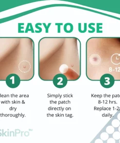 SkinPro™ Skin Tag Remover Patch