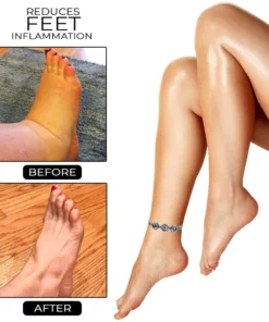 AntiSwelling Obsidian MagneticTherapy Anklet