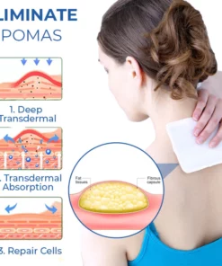 KoMedi™ Lipoma Relief Patch