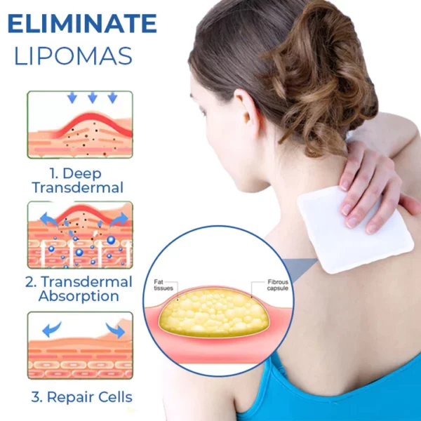 KoMedi™ Lipoma Relief Patch