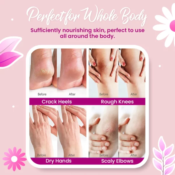 Rechargeable Electric Foot Callus Remover